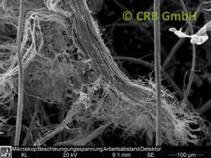 REM-Bild Chrysotil-Asbest in Promabest | © CRB Analyse Service GmbH